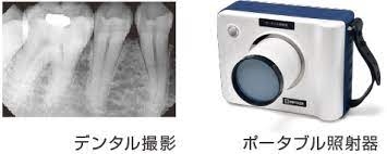 訪問診療レントゲン