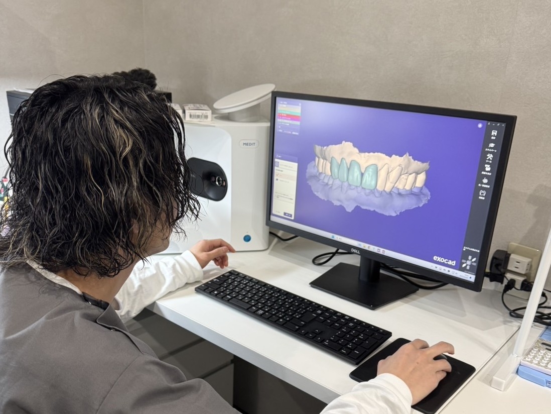 歯科技工士が常駐しています